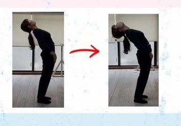 施術前後の姿勢の変化（ビフォーアフター）