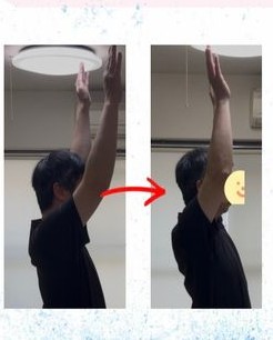 施術前後の肩の可動域の変化（ビフォーアフター）