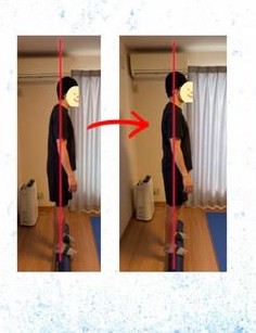 施術前後の立ち姿勢の変化（ビフォーアフター）